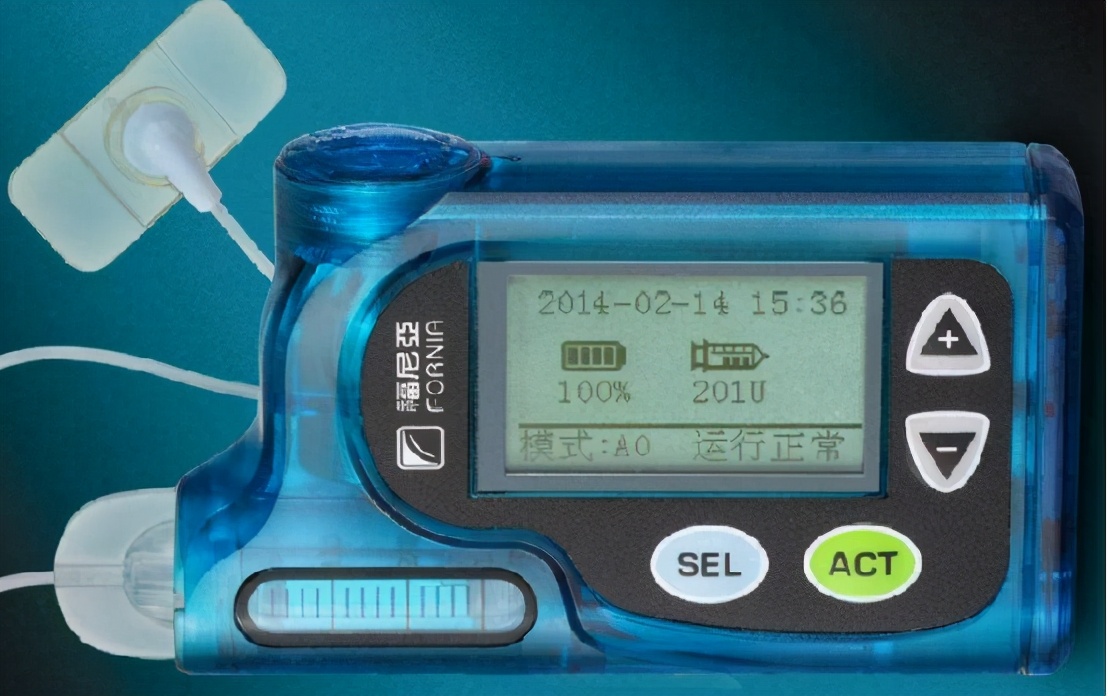 优泵胰岛素泵最新价格,德国胰岛素泵品牌及价格