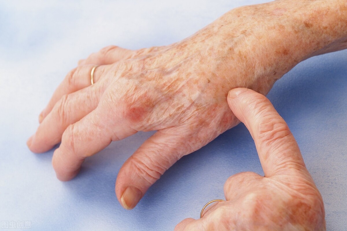 一分钱一分货莫乱说价格,一块钱一片的非布司他