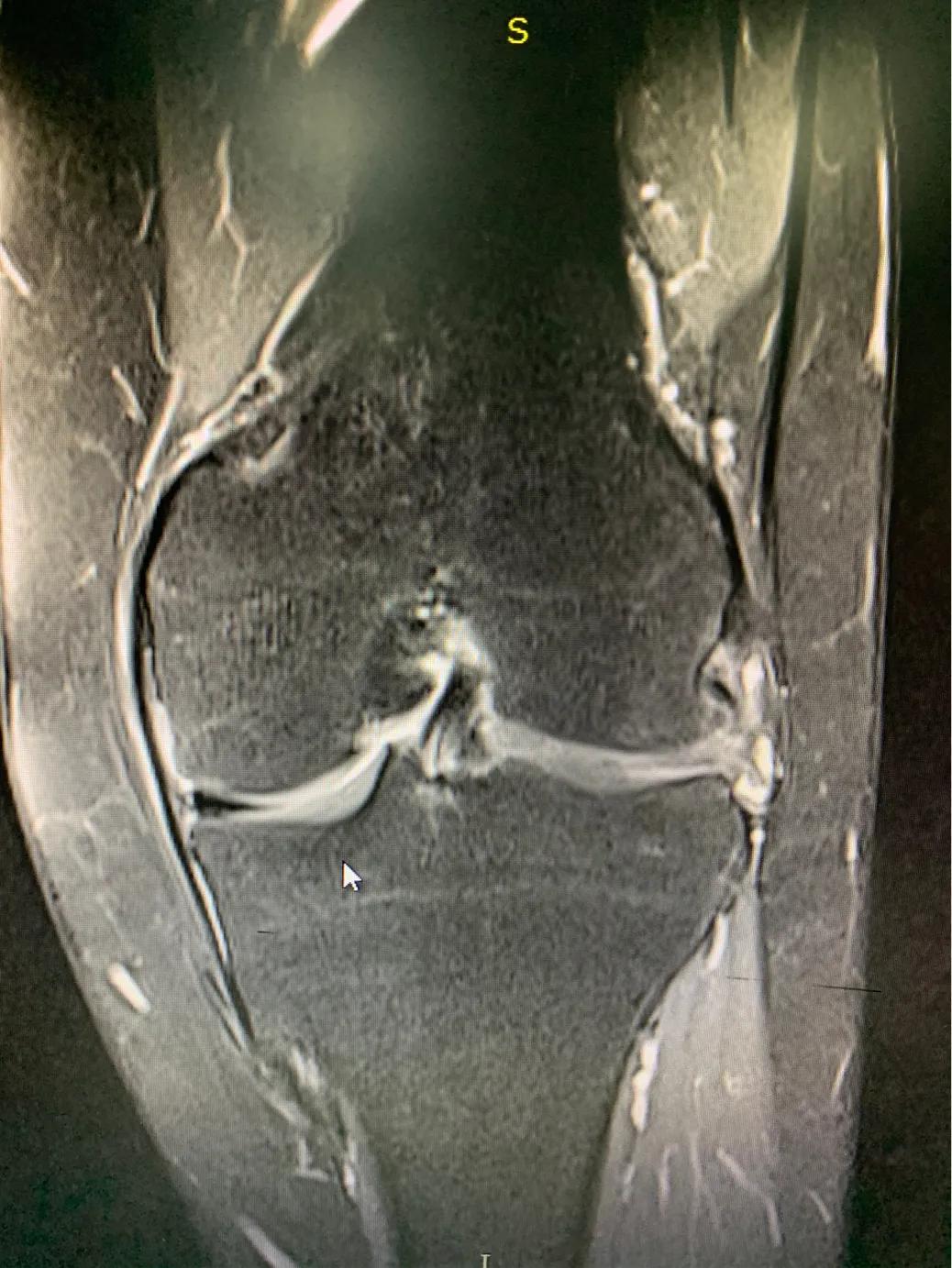下蹲是按住好还是切换好,下蹲正确与错误对比图
