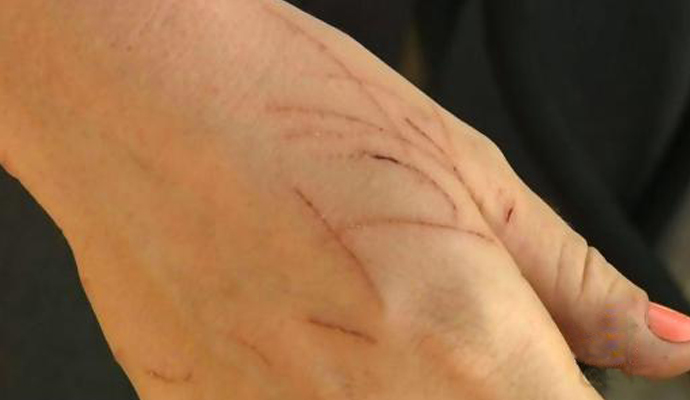 被猫抓了怎么确定猫有没有狂犬病,猫得了狂犬病抓人才要打疫苗吗