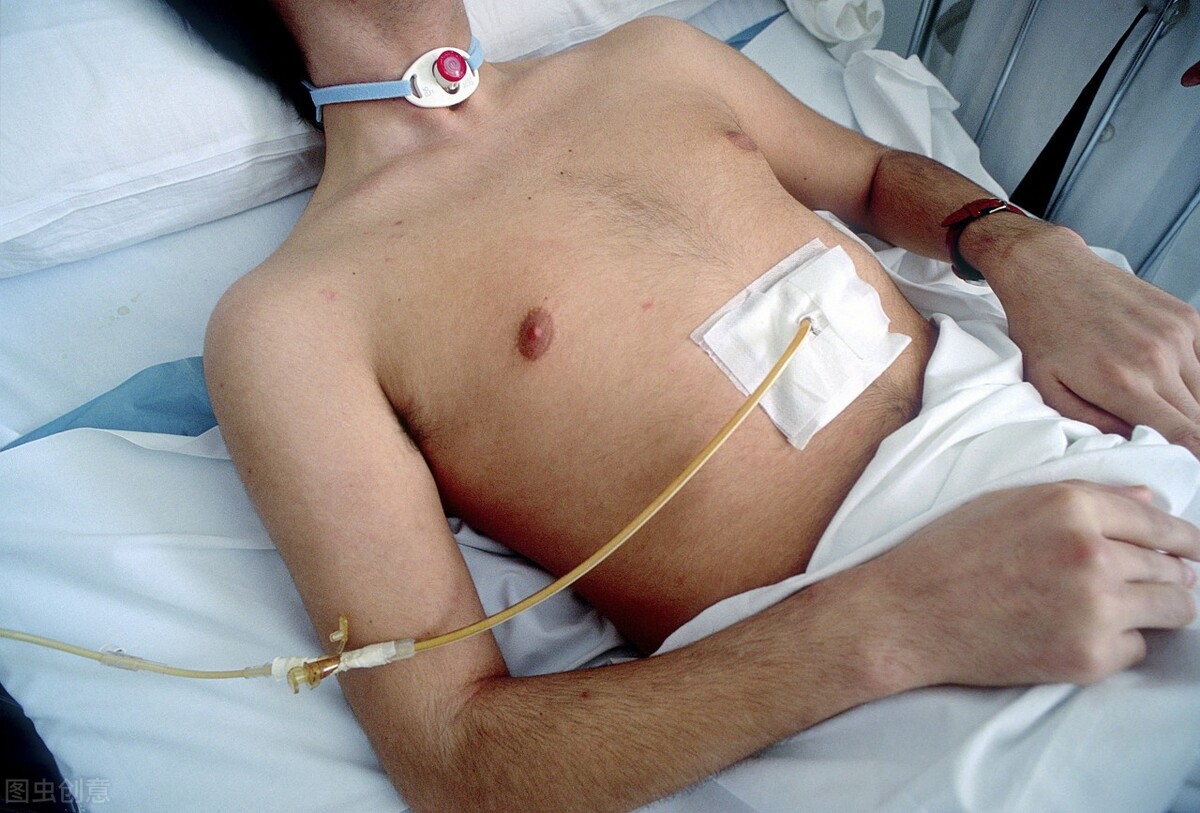 肠癌术后造口那渗血怎么回事,肠癌术后造口的并发症