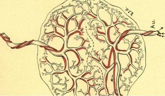 妇科疾病的介入治疗，这四种妇科疾病不用切除子宫也可以治好