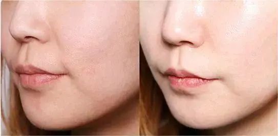 澳洲清爽物理防晒霜好用吗,澳洲沙滩级防晒