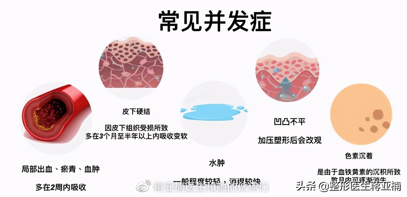 一次性说清,一次性说清要求