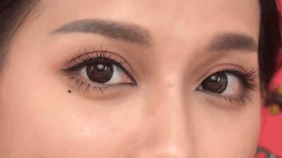 皮肤松弛引起的眼袋怎么祛除,祛除眼袋的小妙招红霉素软膏