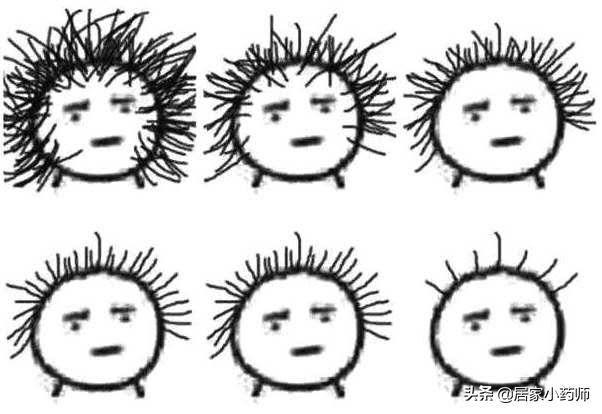 生理性脱发导致秃了怎么办,秃如其来脱发青年这样自救