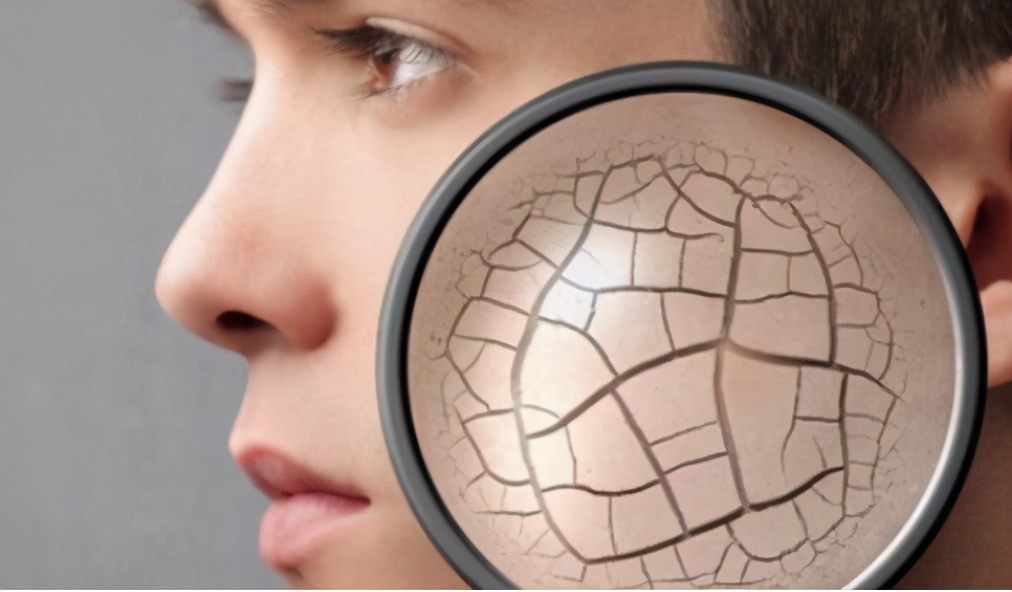 脸上皮肤干燥有皱纹,缓解冬季瘙痒的七种方法