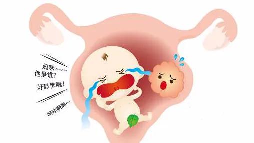 专家讲子宫肌瘤,如果怀孕了发现有子宫肌瘤怎么办