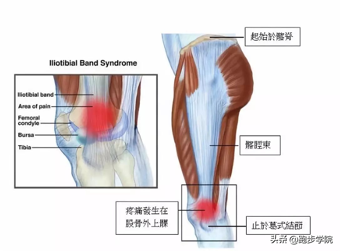 跑步膝盖疼痛自检,跑步大神们初跑时有膝盖疼的问题