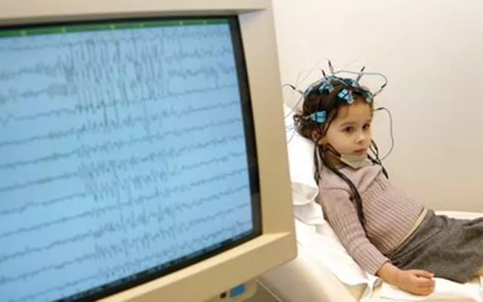 癫痫的治疗原则是哪些,癫痫反复发作药物治疗原则