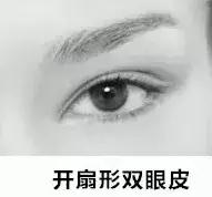 男生割内双眼皮手术,男子去割单眼皮后的结果