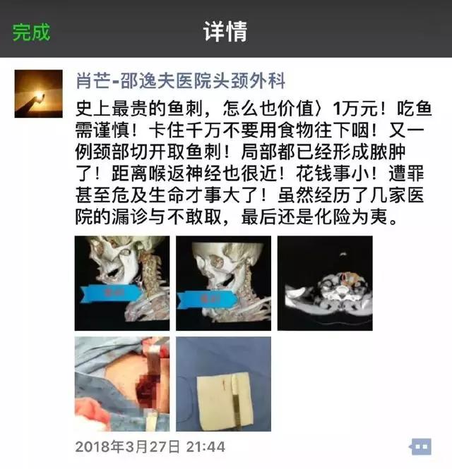 吃鱼刺被卡到,吃鱼刺把喉咙卡破了怎么办