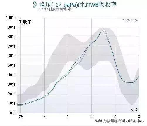 耳硬化症通过什么检查,耳硬化症的诊疗计划