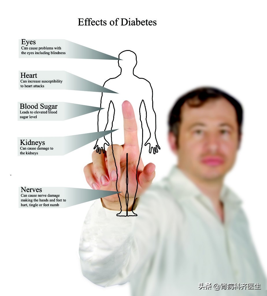 83岁老人患糖尿病肾病如何治疗,国内治疗糖尿病肾病哪家医院最好