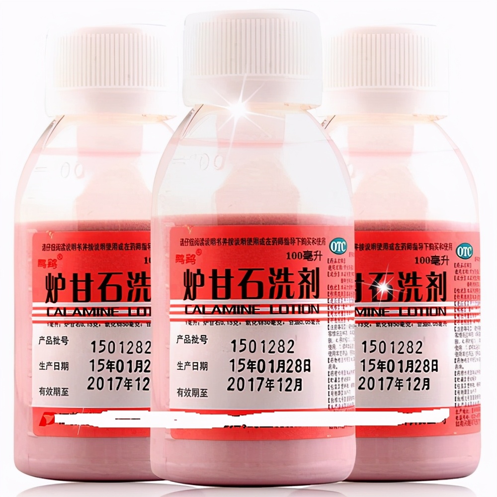 妊娠痒疹要怎么治疗,妊娠痒疹是怎么治愈