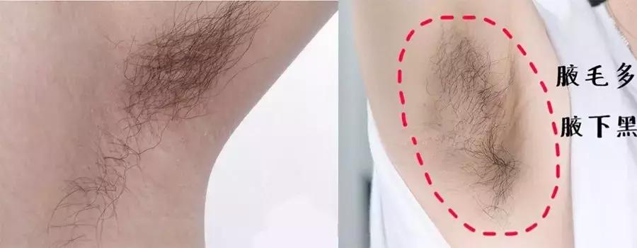 不做猕猴桃女孩是什么意思,不做猕猴桃女孩的图片