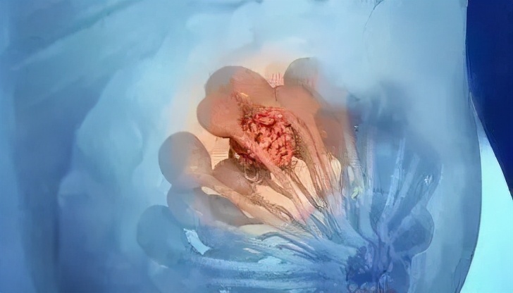 「科学体检全攻略」女性体检,注意这两点,少花钱少走弯路