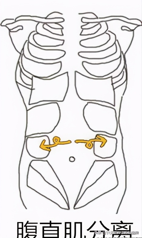 不管是顺产还是刨腹产，宝爸和宝妈都需要知道的产后恢复知识