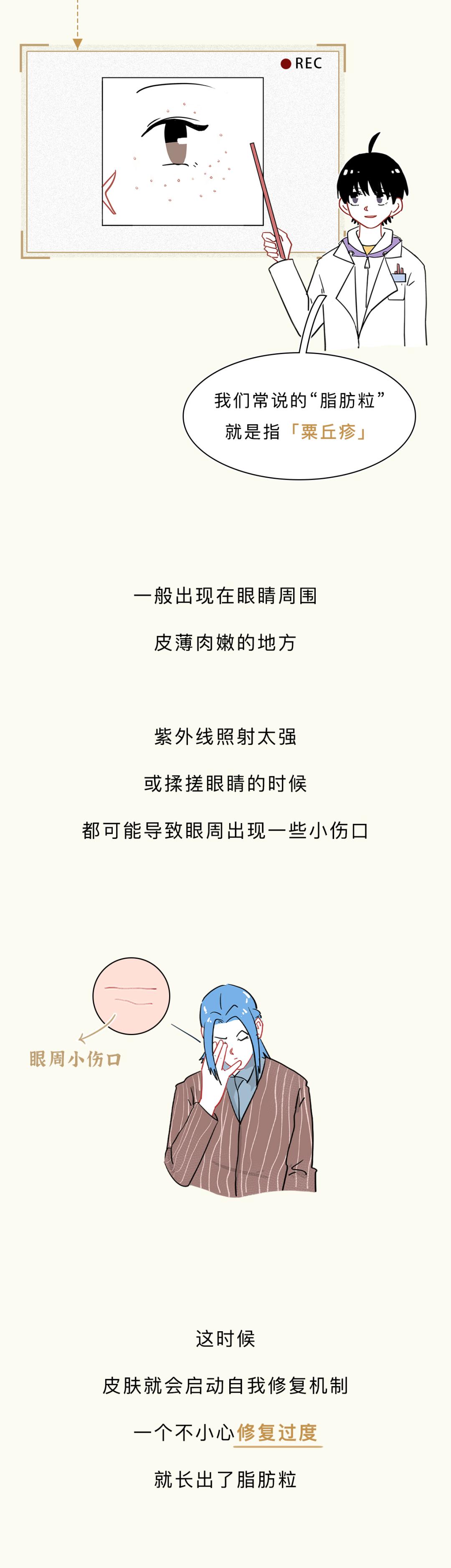 眼睛周围为什么会有脂肪粒,眼睛周围的脂肪粒怎么造成的