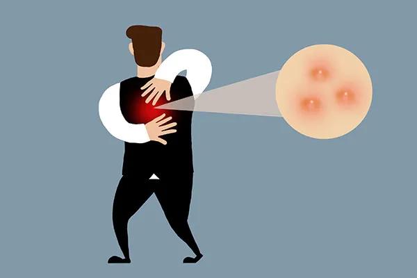 床上有螨虫用什么除螨药最好,床上如果有螨虫会怎么样