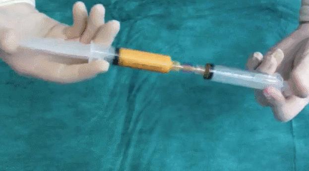 全脸填充纯脂肪和svf有什么区别,干细胞和脂肪填充的区别