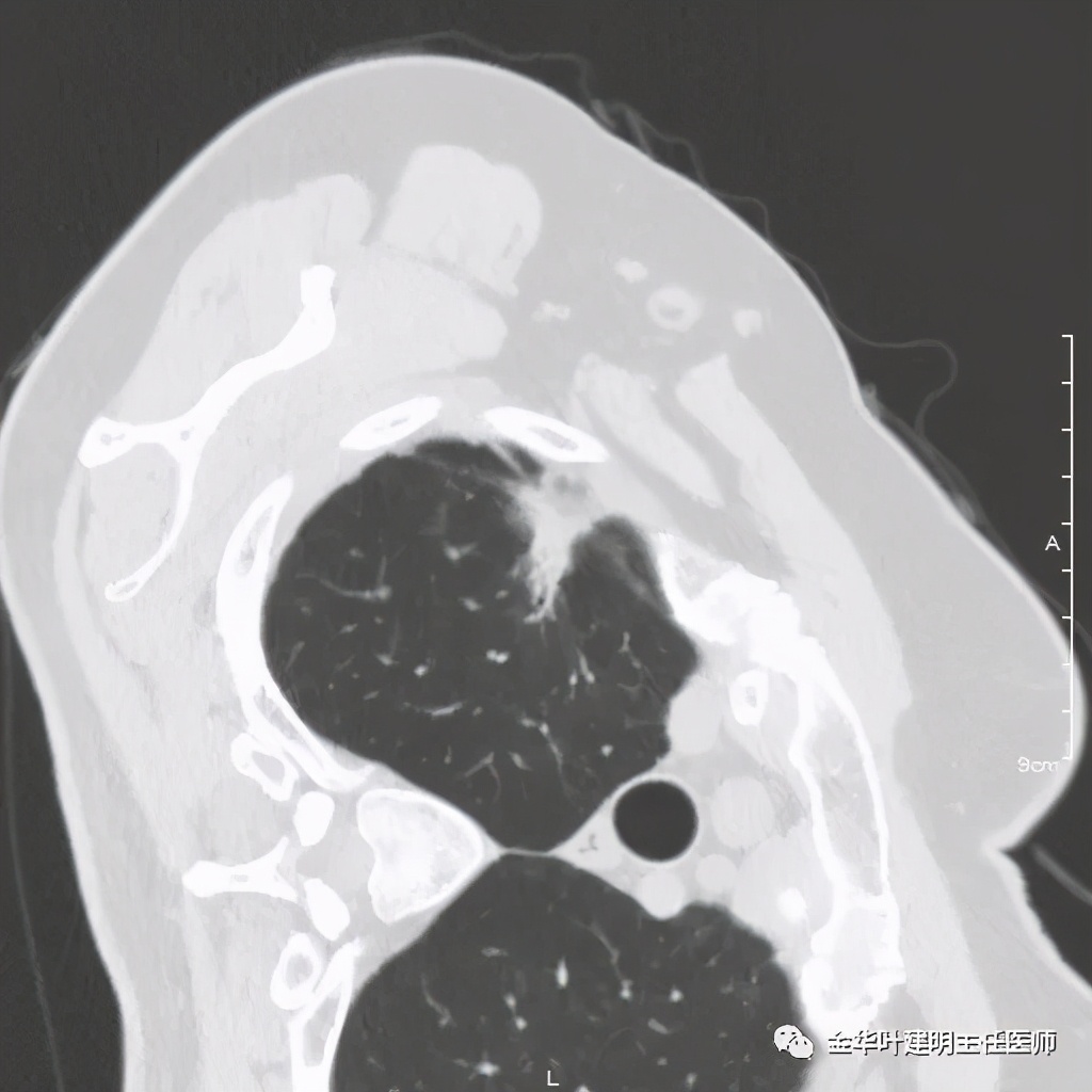 放个大招完整版教学,放个大招完整版前奏