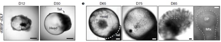 脱发人群超25亿解救头发从它开始,脱发最新研究成果