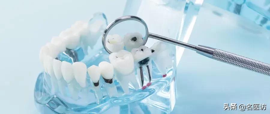 牙齿快烂了是拔还是补,牙齿烂剩下根了怎么拔