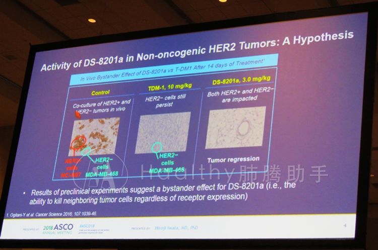 her2肺癌靶向药入集采了吗,肺癌her2靶向药治愈率