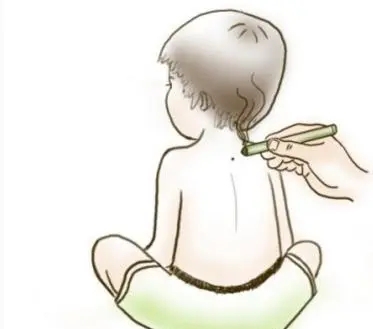 小儿艾灸的正确方法,儿童的艾灸书推荐