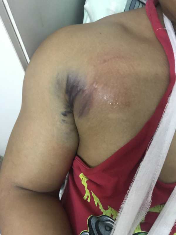 健身教练举杠铃被压伤,健身教练卧举380斤失败