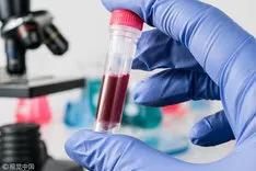 发现隐血和尿蛋白怎么治疗,尿潜血阳性是怎么回事严重吗