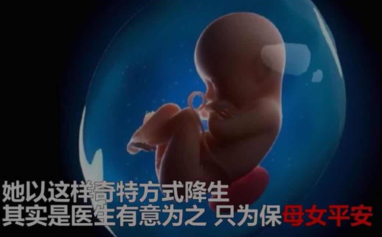 孩子出生的时候裹着羊膜囊怎么办,女婴连体衣护肚子