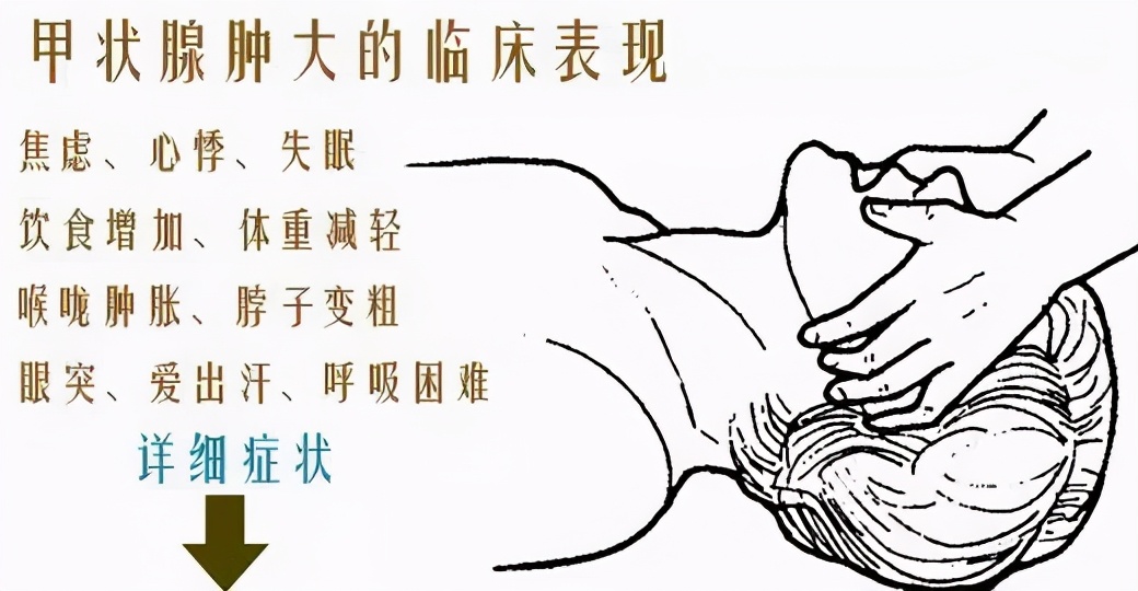 甲亢甲减结节能治愈吗,桥本甲状腺结节伴有甲亢怎样治疗