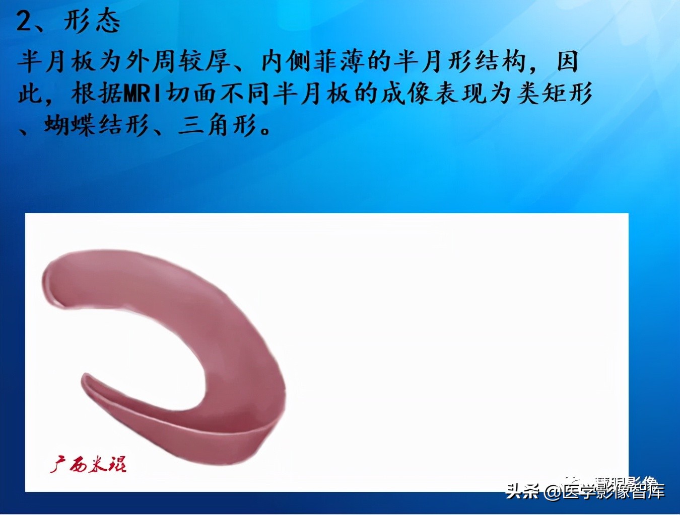 膝关节半月板损伤的解剖结构图,半月板mri解剖图解