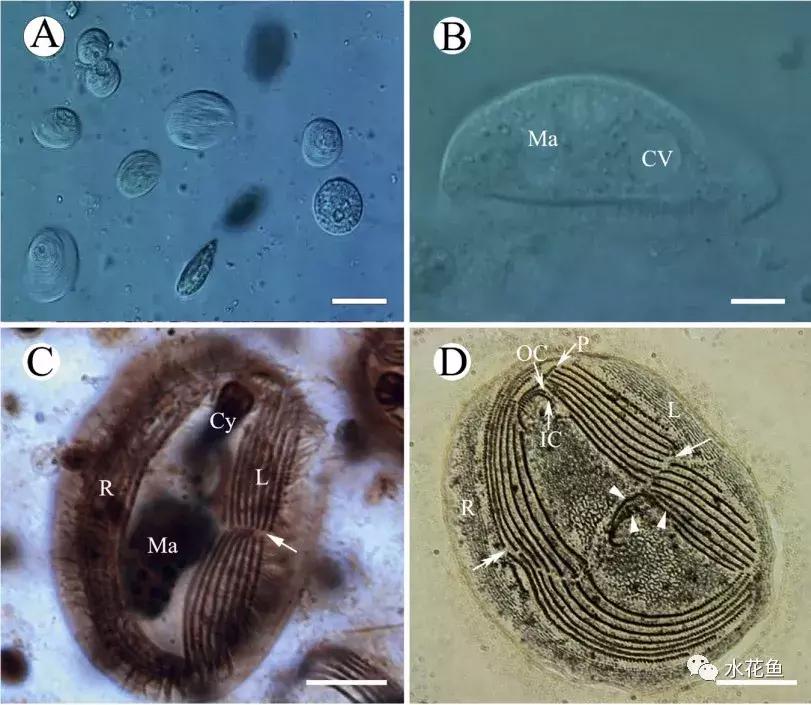 暴发“鱼瘟”救治时不可忽视寄生虫的危害---低温时节鱼类斜管虫病的症状及防治