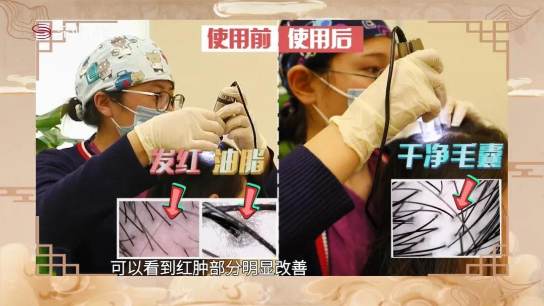 明星亲测|康王创始人83岁再出山，挑战5天内不洗头