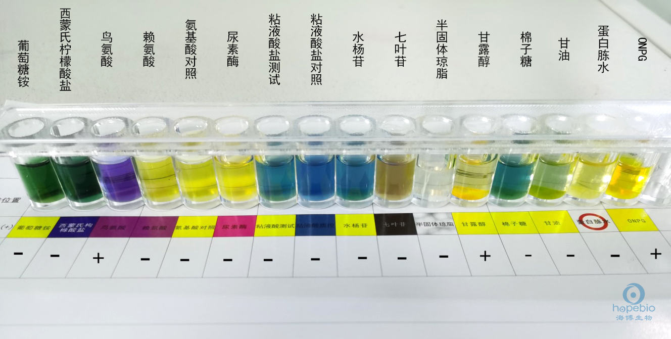 食品中志贺氏菌的检测,志贺氏菌检测标准值是不得检出吗