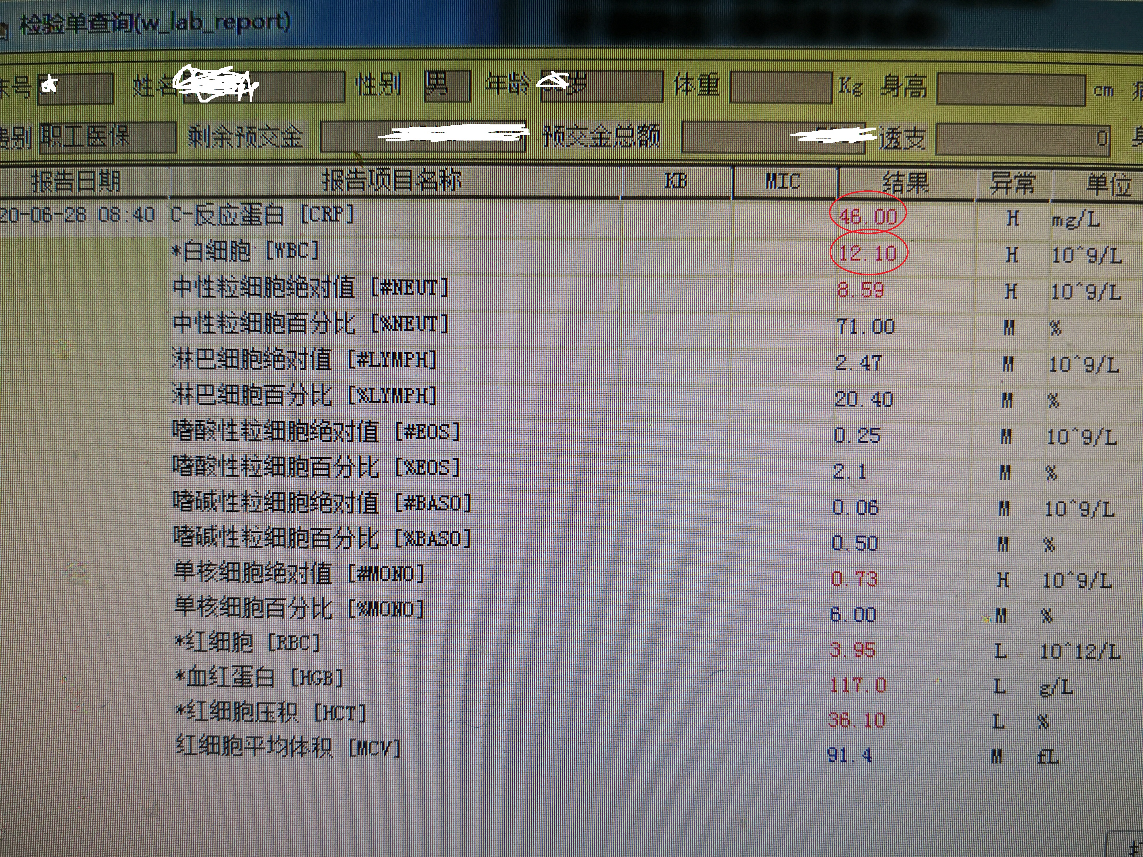 重症肺炎的急救配合要点,重症肺炎针对性护理措施