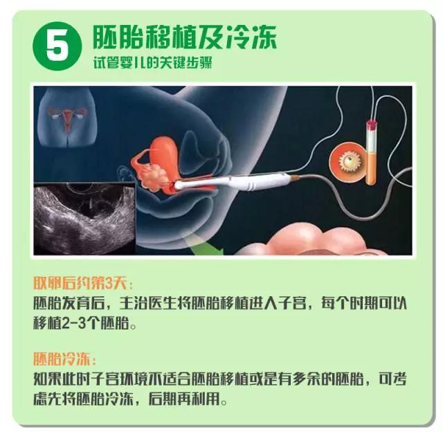 做试管太多人知道好不好,做试管请了多少假