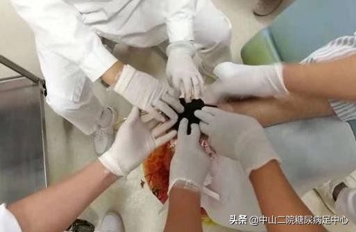 预防糖尿病足的锻炼方法,糖尿病足适合什么运动