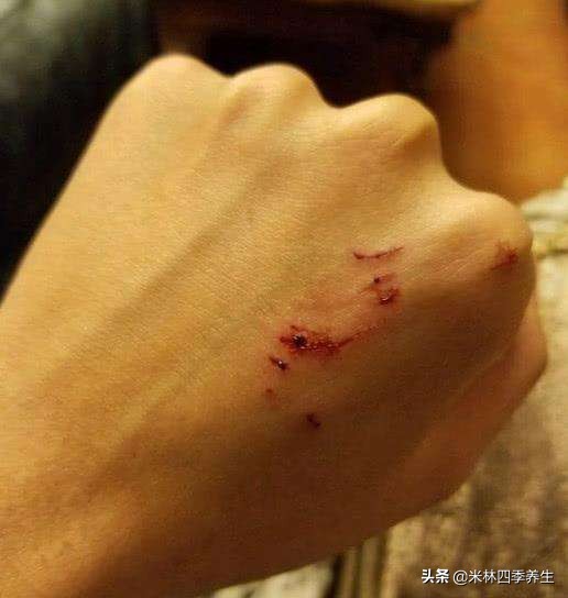 面对病毒，最好的办法就是增强免疫力，告诉你增强免疫力的方法