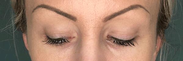 长期开车眼睛疲劳有什么好办法,长期开车有助于恢复视力