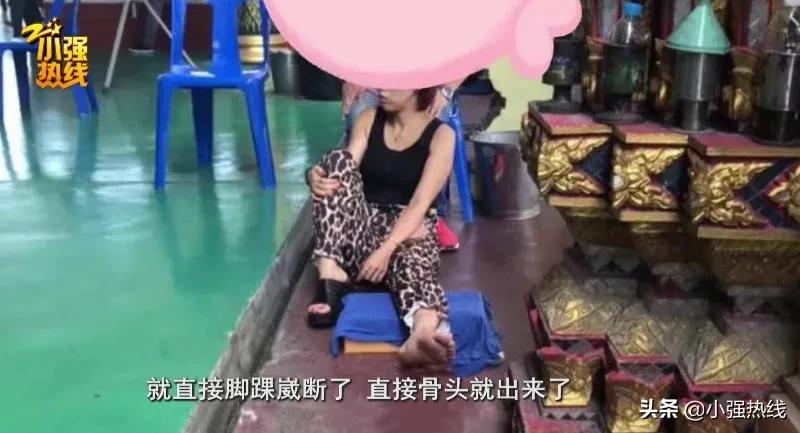 女子旅游崴脚骨折索赔18w,女子扭伤脚踝拆钢板赔偿