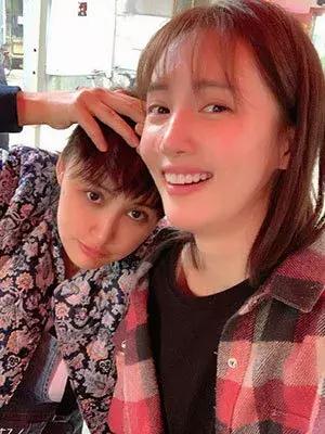 拯救发际线告别大额头,拯救发际线不走冤枉路