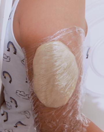 肌注部位红肿疼痛起硬结怎么处理,肌注部位及方法