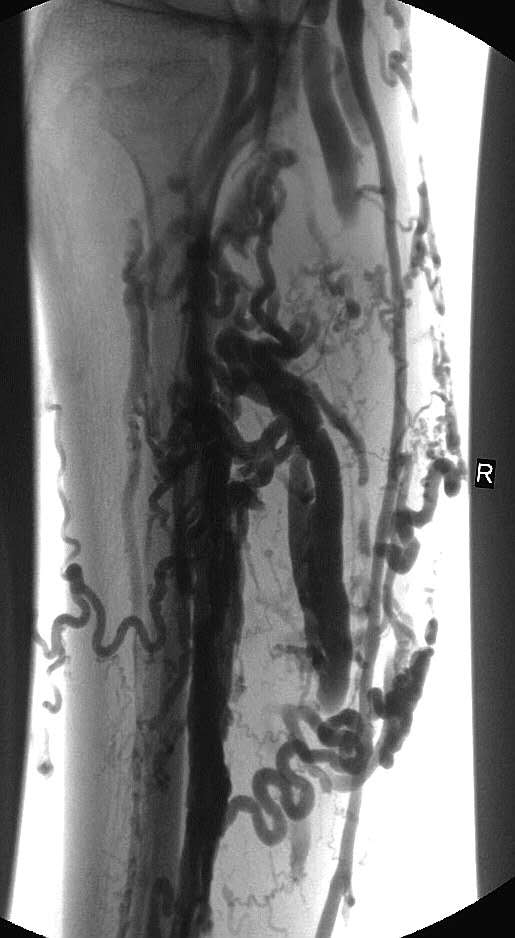 小腿老是发麻有沉重感看什么科,下肢腿部沉重是什么原因造成的