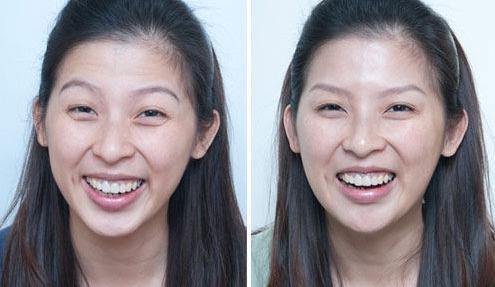 戚薇涂眼霜真的有效果吗,戚薇分享眼霜涂抹方法