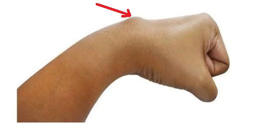 什么是癌症病理学,什么是癌症中医治疗