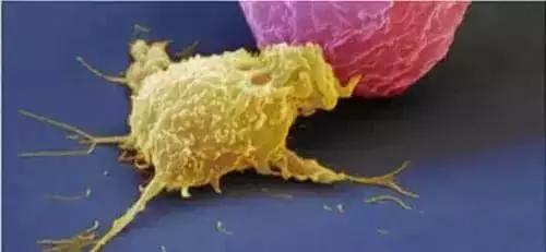 120万一针的抗癌药能彻底消灭癌吗,有效抑制癌症的药